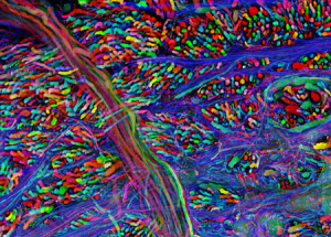 brainbow1